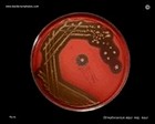 streptococcus equi